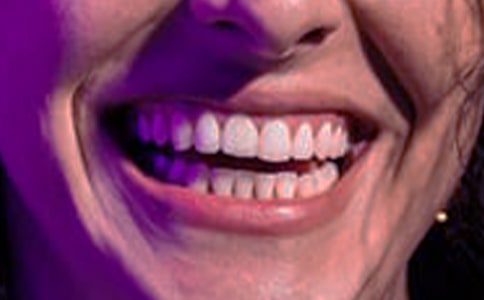 ������Ѫ��ʲôԭ��